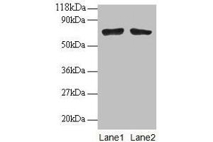 Western blot All lanes: BMI1 antibodyt 2 μg/mL Lane 1: EC109 whole cell lysate Lane 2: 293T whole cell lysate Secondary Goat polyclonal to rabbit IgG at 1/15000 dilution Predicted band size: 37 kDa Observed band size: 70 kDa (BMI1 抗体  (AA 1-247))