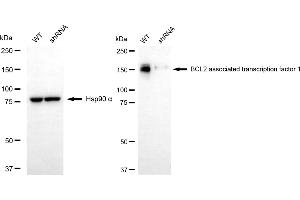 Western blotting analysis using BCL2 associated transcription factor 1 antibody (ABIN7797747).