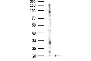 Western blot analysis of lysates from COLO205 cells(heat-shock,45 min treatment), using Phospho-Stathmin 1 (Ser16) Antibody at 1/1000 dilution.