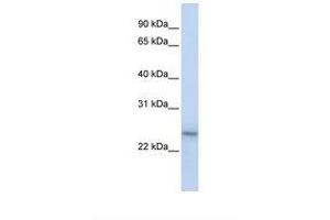Image no. 1 for anti-Proteasome (Prosome, Macropain) Subunit, beta Type, 9 (Large Multifunctional Peptidase 2) (PSMB9) (C-Term) antibody (ABIN6738209)