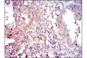 Immunohistochemistry (IHC) image for anti-Forkhead Box O1 (FOXO1) antibody (ABIN1845870) (FOXO1 抗体)