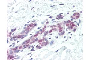 Anti-DFFA / ICAD antibody IHC of human breast. (DFFA 抗体  (AA 2-21))
