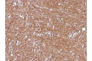 IHC testing of FFPE human cerebellum with NSE antibody (clone ENO2/1375). (ENO2/NSE 抗体  (AA 416-433))