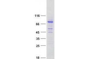 Validation with Western Blot