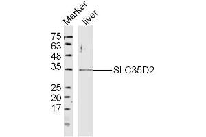 Mouse Liver lysates probed with SLC35D2 Polyclonal Antibody, Unconjugated  at 1:300 dilution and 4˚C overnight incubation. (Solute Carrier Family 35 (UDP-GlcNAc/UDP-Glucose Transporter), Member D2 (SLC35D2) (AA 251-326) 抗体)