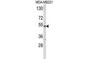 Western Blotting (WB) image for anti-Cytochrome P450, Family 2, Subfamily A, Polypeptide 13 (CYP2A13) antibody (ABIN3003850) (CYP2A13 抗体)