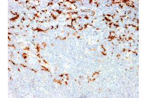 Formalin-fixed, paraffin-embedded human Lymph Node in Colon stained with CD163 Mouse Monoclonal Antibody (M130/2164). (CD163 抗体  (AA 43-196))