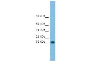 WB Suggested Anti-C13orf30 Antibody Titration: 0. (C13orf30 抗体  (N-Term))
