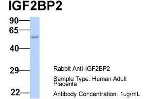 Host:  Rabbit  Target Name:  IGF2BP2  Sample Type:  Human Adult Placenta  Antibody Dilution:  1.