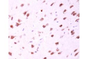 IHC-P Image MFN2 antibody [N1N2], N-term detects MFN2 protein at cytosol on mouse fore brain by immunohistochemical analysis. (MFN2 抗体  (N-Term))