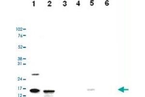 Western Blot analysis of (1) 25 ug whole cell extracts of Hela cells, (2) 15 ug histone extracts of Hela cells, (3) 1 ug of recombinant histone H2A, (4) 1 ug of recombinant histone H2B, (5) 1 ug of recombinant histone H3, (6) 1 ug of recombinant histone H4. (HIST1H3A 抗体  (acLys36))