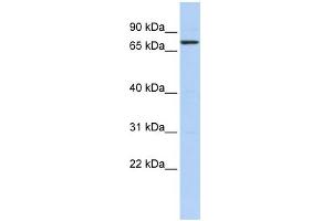WB Suggested Anti-KLHL5 Antibody Titration:  0. (KLHL5 抗体  (N-Term))