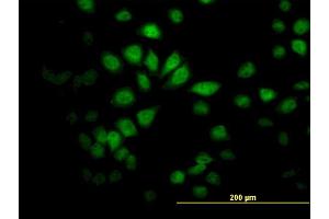 Immunofluorescence of monoclonal antibody to SAV1 on HeLa cell. (SAV1 抗体  (AA 300-383))