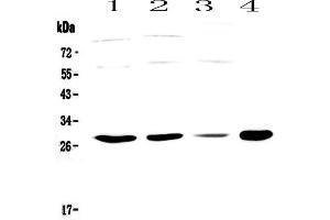 Western blot analysis of PHO1 using anti-PHO1 antibody . (APOBEC3A 抗体  (AA 1-63))