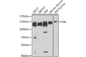 Western blot analysis of extracts of various cell lines, using CBL antibody (ABIN6131302, ABIN6138002, ABIN6138004 and ABIN6213970) at 1:1000 dilution. (CBL 抗体  (AA 637-906))