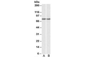 Western blot testing of A) HepG2 and B) MCF7 cell lysate with GRP78 antibody at 0. (GRP78 抗体)