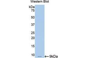 Western blot analysis of the recombinant protein. (Resistin 抗体  (AA 45-114))