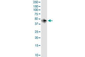 BCAT1 monoclonal antibody (M02), clone 1F8. (BCAT1 抗体  (AA 1-320))