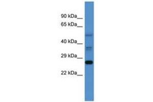 COMMD2 anticorps  (AA 72-121)