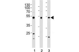 Western blot analysis of lysate from (1) HepG2, (2) HT-29, and (3) SW620 cell line using FOXA2 antibody at 1:1000. (FOXA2 抗体  (C-Term))