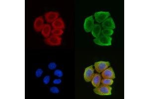 ABIN6259090 and ABIN6274229 staining Hela cells(30 min of UV treatment) by IF/ICC. (KAP1 抗体  (Internal Region))