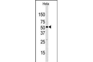 Western blot analysis of anti-JMJD2D (C-term) Pab in Hela cell line lysate. (JMJD2D 抗体  (C-Term))