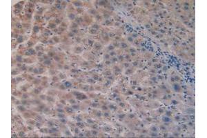 IHC-P analysis of Human Liver Tissue, with DAB staining. (CS 抗体  (AA 103-394))