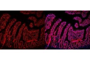 IF analysis of HMGB2 using anti-HMGB2 antibody (ABIN4886620). (HMGB2 抗体  (N-Term))