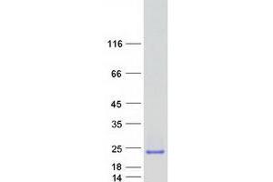 Western Blotting (WB) image for Crystallin, gamma D (CRYGD) protein (Myc-DYKDDDDK Tag) (ABIN2721678)