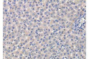 ABIN6260590 and ABIN6278435 at 1/100 staining Rat liver tissue by IHC-P.
