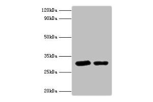 Western blot All lanes: Syntaxin-6 antibody at 2 μg/mL Lane 1: Mouse brain tissue Lane 2: 293T whole cell lysaye Secondary Goat polyclonal to rabbit IgG at 1/10000 dilution Predicted band size: 29 kDa Observed band size: 29 kDa (Syntaxin 6 抗体  (AA 4-231))