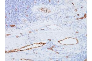 Formalin-fixed, paraffin-embedded human Tonsil stained with vWF Mouse Monoclonal Antibody (3E2D10). (VWF 抗体  (AA 845-949))