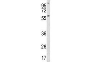 ETV5 antibody western blot analysis in A549 lysate (ETV5 抗体  (AA 8-37))