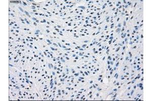 Image no. 1 for anti-Fc Fragment of IgG, Low Affinity IIa, Receptor (CD32) (FCGR2A) antibody (ABIN1497264) (FCGR2A 抗体)
