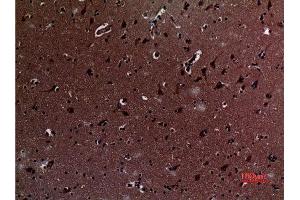 Immunohistochemistry (IHC) analysis of paraffin-embedded Human Brain, antibody was diluted at 1:100. (IL12A 抗体  (Internal Region))