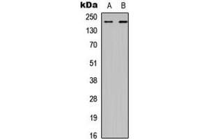 Western blot analysis of CHD2 expression in HEK293T (A), A549 (B) whole cell lysates. (CHD2 抗体  (Center))