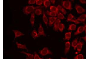 Immunofluorescence (fixed cells) (IF/ICC) image for anti-Melanoma Antigen Family A, 1 (Directs Expression of Antigen MZ2-E) (MAGEA1) (C-Term) antibody (ABIN6263071)