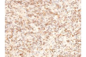 ABIN6267236 at 1/100 staining human appendiceal tissue sections by IHC-P.