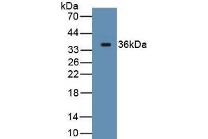 Detection of Recombinant CD163, Rat using Monoclonal Antibody to Cluster Of Differentiation (CD163) (CD163 抗体  (AA 693-939))