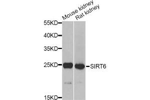Western blot analysis of extracts of various cell lines, using MSRA Antibody. (MSRA 抗体)