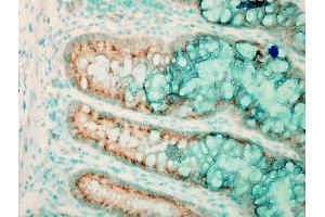 Immunohistochemistry analysis using Rabbit Anti-TLR4 Polyclonal Antibody .