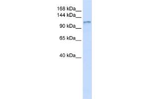 WB Suggested Anti-DGKH Antibody Titration:  0. (DGKH 抗体  (Middle Region))
