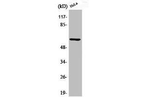 Western Blot analysis of HeLa cells using Phospho-Akt1 (S246) Polyclonal Antibody