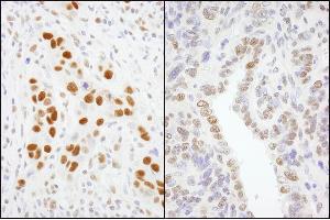 Immunohistochemistry (IHC) image for anti-General Transcription Factor III (GTF2I) (AA 935-985) antibody (ABIN7454739) (GTF2I 抗体  (AA 935-985))