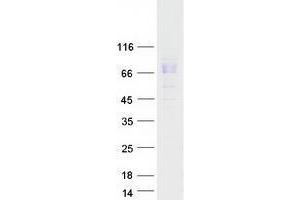 Validation with Western Blot