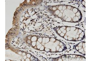Immunoperoxidase of monoclonal antibody to TUBB2A on formalin-fixed paraffin-embedded human colon. (TUBB2A 抗体  (AA 1-445))