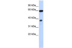 RCC2 antibody used at 1 ug/ml to detect target protein. (RCC2 抗体  (Middle Region))