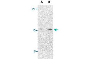 Western blot analysis of CBLN1 in 293 cell lysate with CBLN1 polyclonal antibody  at (A) 2 and (B) 4 ug/mL . (CBLN1 抗体  (C-Term))