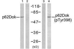 Western blot analysis of extracts from K562 cells, using p62Dok (Ab-398) antibody (E021269, Lane 1 and 2) and p62Dok (phospho-Tyr398) antibody (E011277, Lane 3 and 4). (DOK1 抗体  (pTyr398))