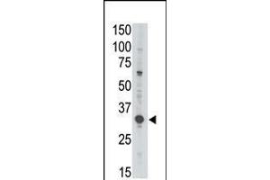 Antibody is used in Western blot to detect MAGEA3 in Jurkat lysate. (MAGEA3 抗体  (C-Term))